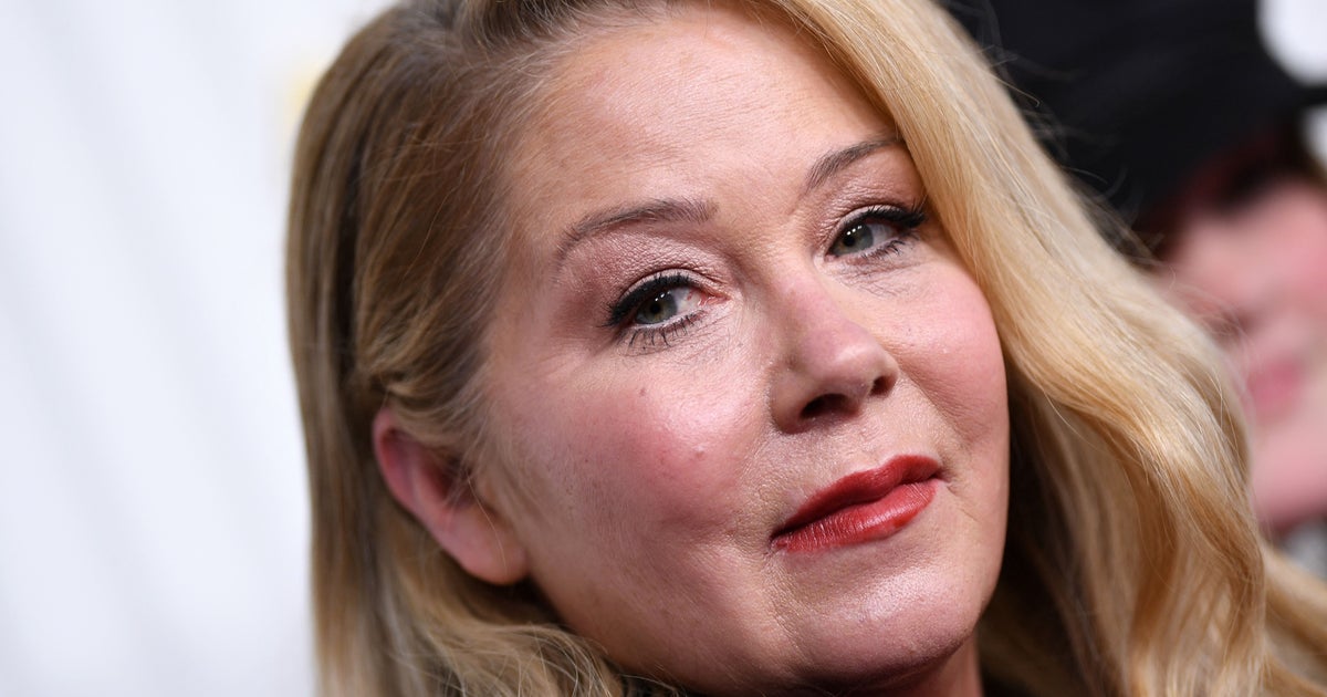 NextImg:Christina Applegate Reveals ‘The Only Plastic Surgery’ She’s Had, And It’s Heartbreaking