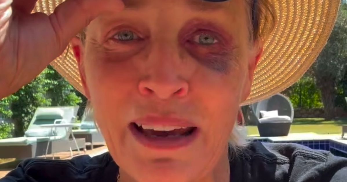 Sharon Stone Shows Off Shiner To Reassure Concerned Fans: ‘I Know You’re All Worried’