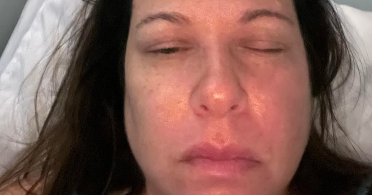 NextImg:I Suffer From The Most Painful Condition Known To Medicine — And My Life Is A Nightmare