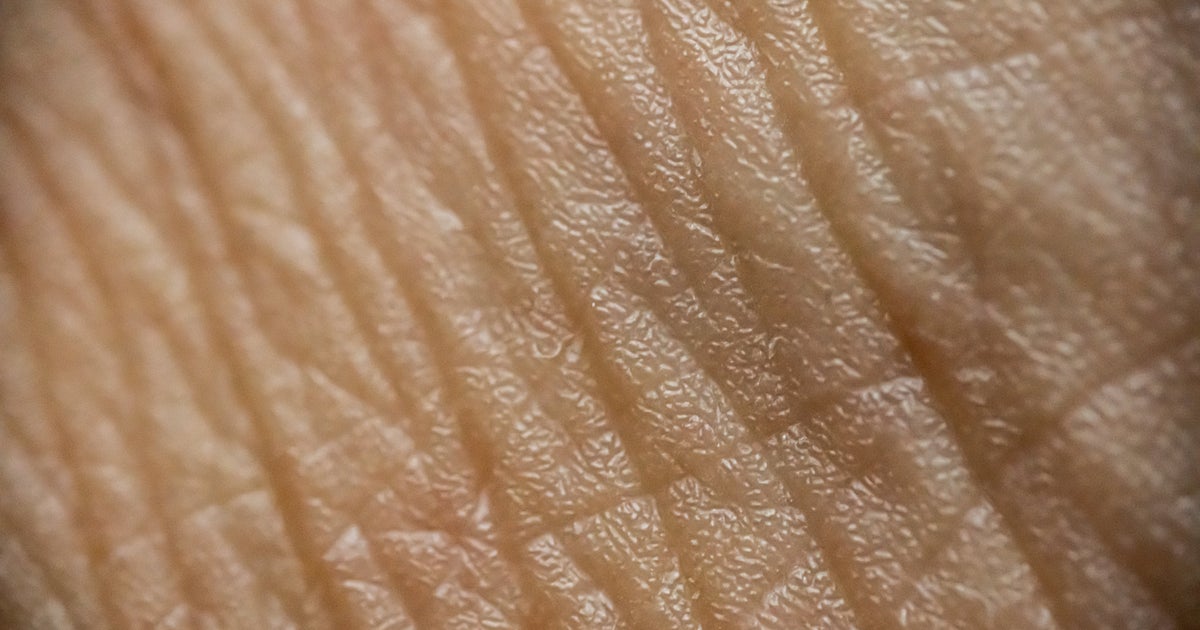 NextImg:So THAT'S Why The Skin On Your Neck Ages Faster Than Your Face