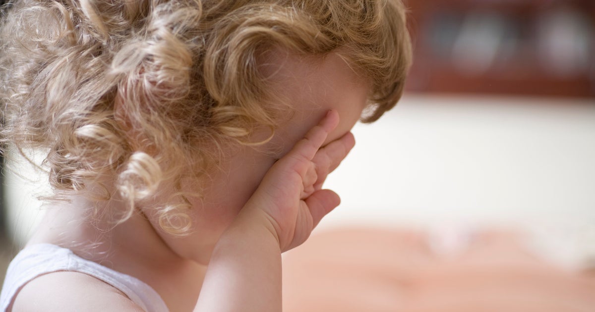 NextImg:What's The Deal With The 'Slapped Cheek' Virus Rapidly Spreading In The U.S.?