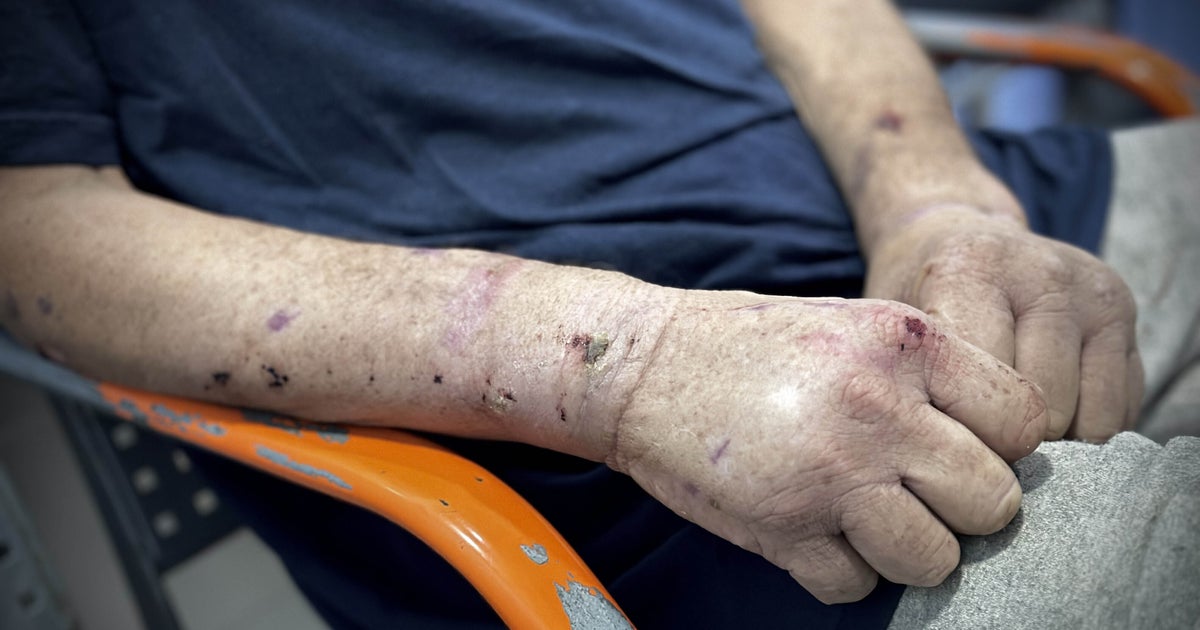 Palestinian Medical Workers Detail Israeli Torture Amid Dire State Of Gaza's Health System