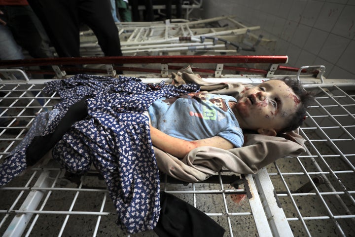 The lifeless body of 2-year-old Anas al-Arair, who was killed in an Israeli strike, is brought to Al-Ahli Baptist Hospital in Gaza City, Gaza, on Wednesday.