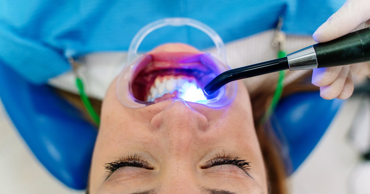 The Dangers Of Unlicensed Teeth Whitening: What To Look For