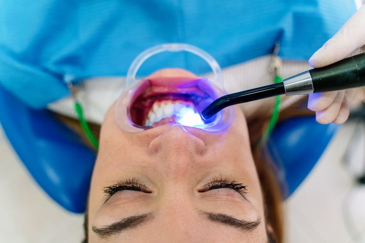 Even if your state does allow non-dentists to perform teeth whitening, dental experts advise the risk isn’t worth the reward. 