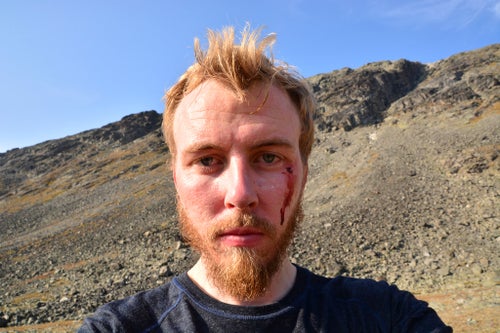 Francis Ari Sture was attacked by a golden eagle in Norway in what an ornithologist says is likely the bird's fourth such attack on humans in the past week. (Francis Ari Sture/UGC)