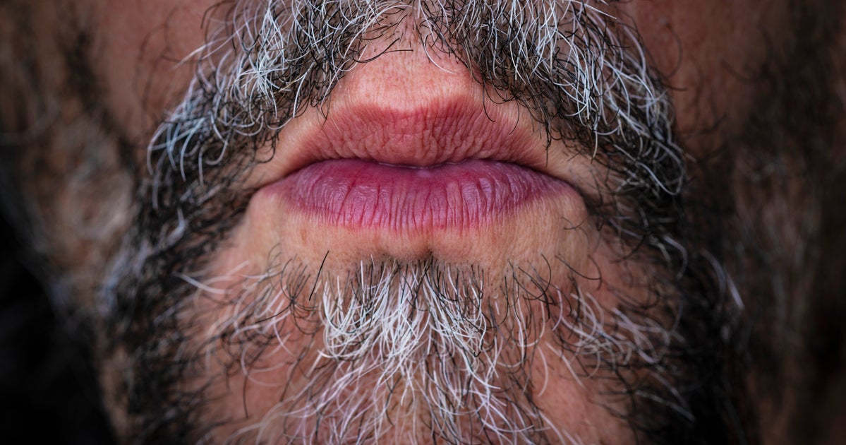 NextImg:If Your Beard Seems Patchier Over Time, You're Not Imagining It