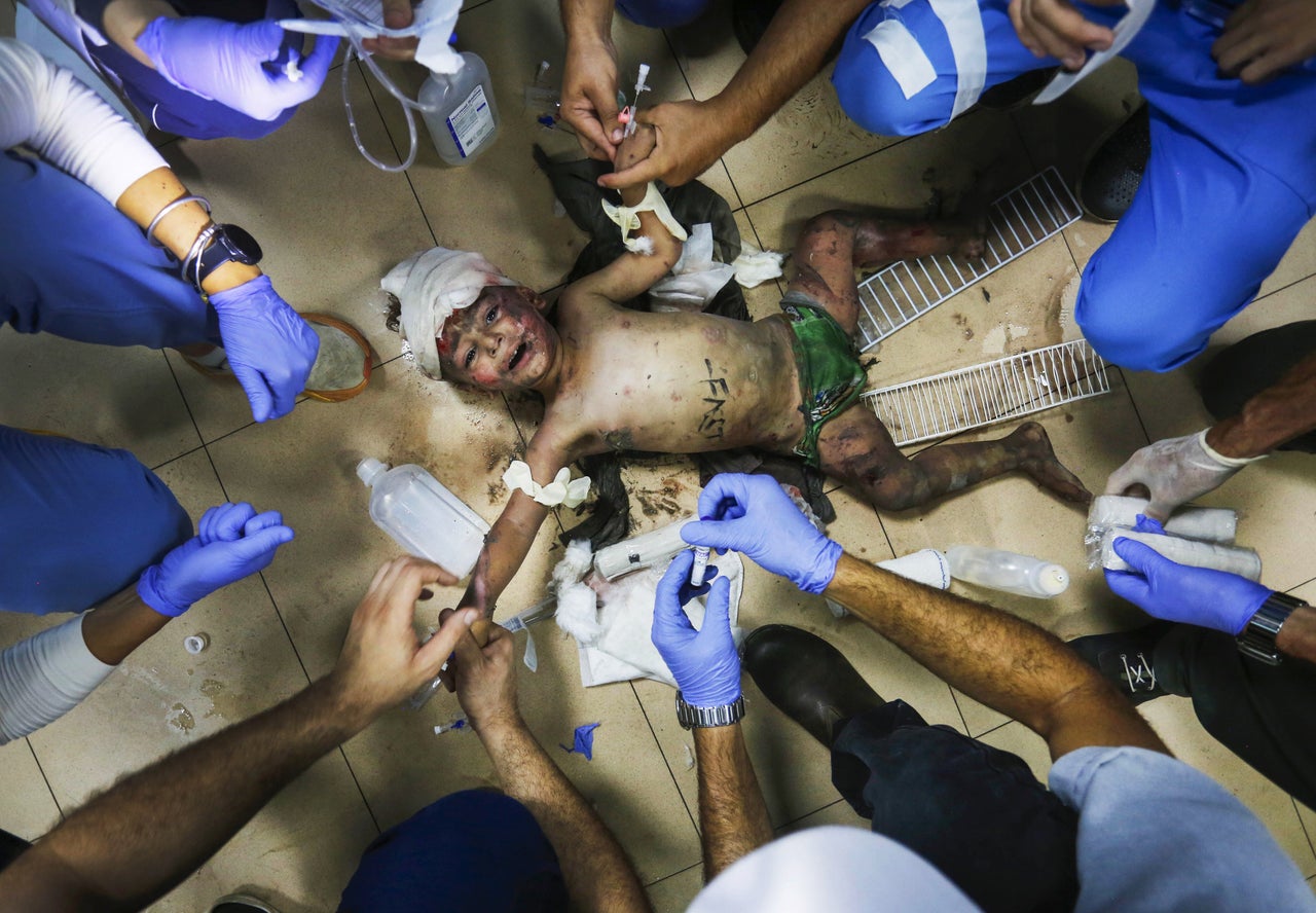 Doctors treat an injured Palestinian child using mobile phone lights due to power outages at Al-Aqsa Martyrs Hospital in Deir Al-Balah, Gaza, on June 29.