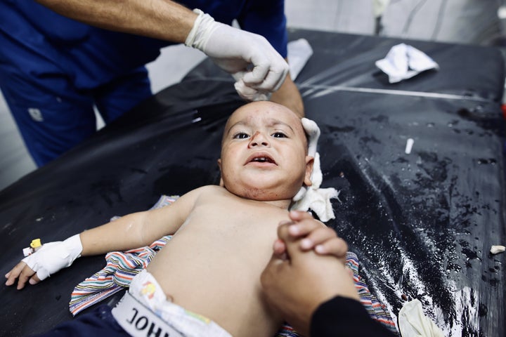 A Palestinian baby receives medical treatment at Kamal Adwan Hospital after dozens were killed in an Israeli attack Sunday on Jabalia camp in northern Gaza.