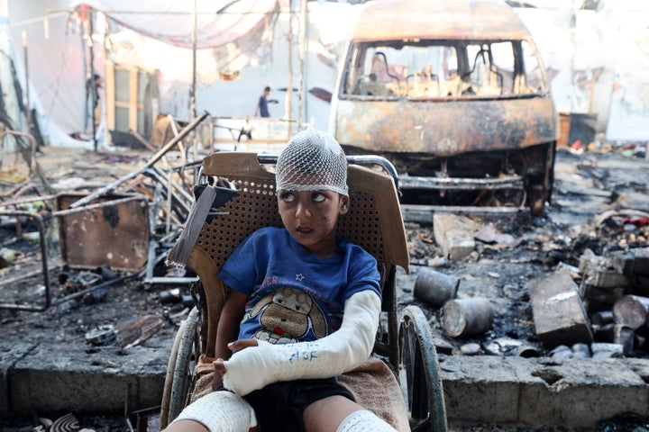 A Palestinian boy looks at the site of an Israeli strike on Al-Aqsa Martyrs Hospital where tents sheltering displaced people went up in flames, in Deir al-Balah, Gaza on October 14, 2024.