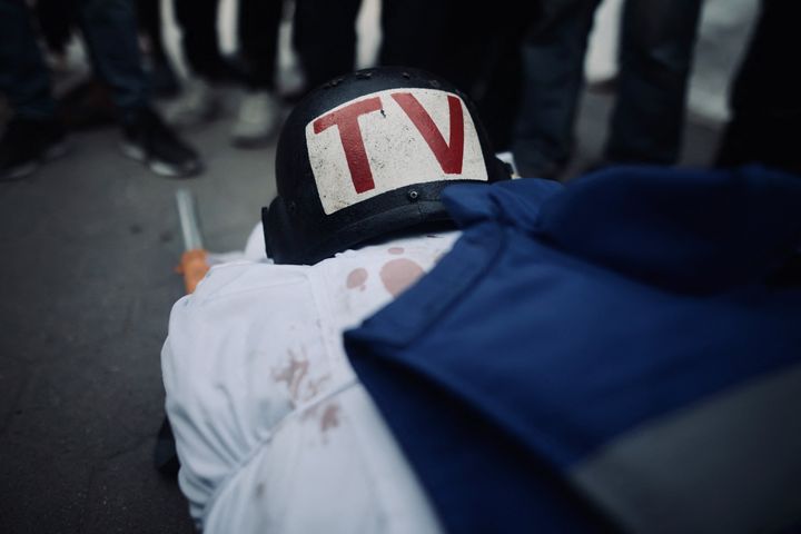 Press equipment belonging to slain Al-Aqsa TV cameraman Mohammed al-Tanani sits on his body during his funeral at Al-Aqsa Baptist Hospital in Gaza City, on Oct. 9, 2024. Al-Tanani was killed in an Israeli attack on the Jabalia refugee camp in northern Gaza.