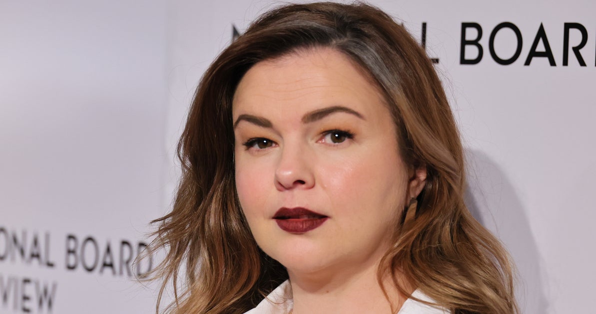 NextImg:Amber Tamblyn Questions Her Decision To Undergo This Cosmetic Surgery At 12