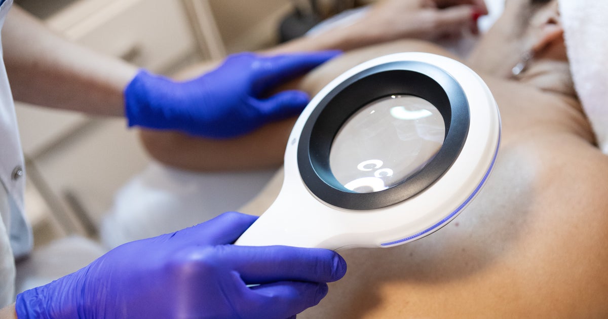 NextImg:The 1 Thing This Skin Cancer Surgeon Says He Would Never Do — Not Even Once