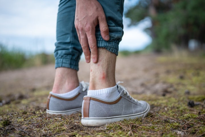 Beware of ticks when outside and pay attention to these signs of Lyme disease.