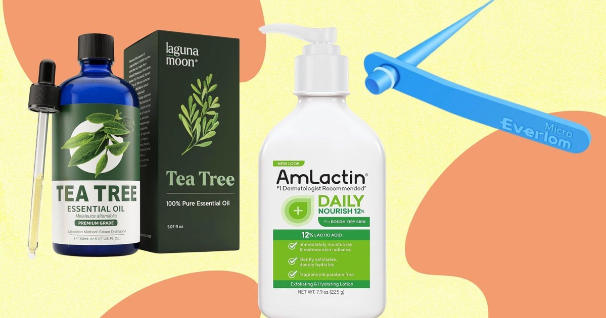 NextImg:Dermatologists Share How To Get Rid Of Skin Tags Safely And Effectively