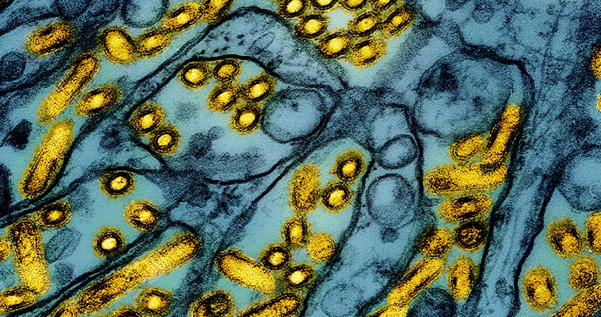 NextImg:Canadian Teen In Critical Condition With Suspected Case Of Bird Flu