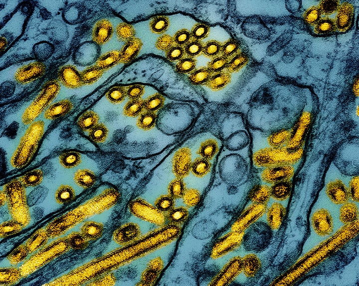 Type A H5N1 of the bird flu virus is seen under a microscope. This virus has been spreading widely in the U.S. among wild birds, poultry, cows and other animals.