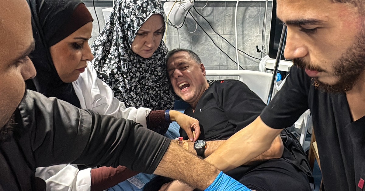 NextImg:Israeli Strike Wounds Director Of North Gaza’s Main Hospital