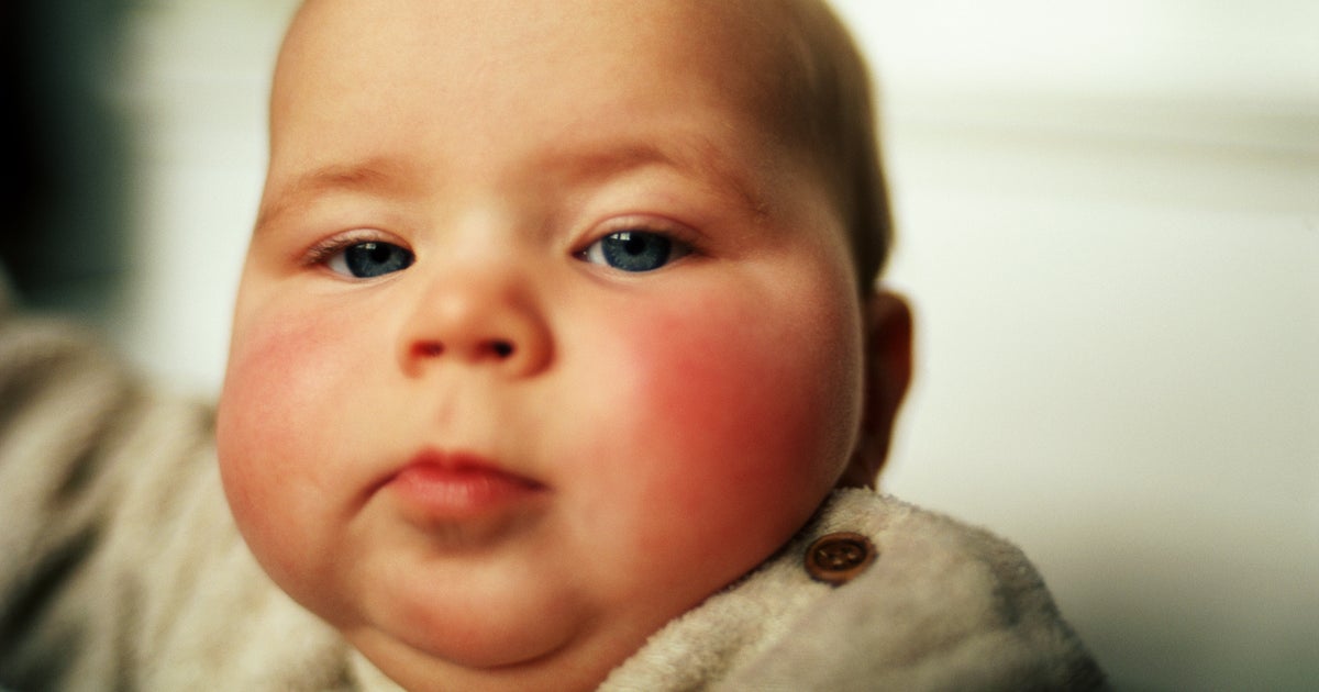 NextImg:If You're Worried About Getting A Double Chin, We Have Good News And Bad News