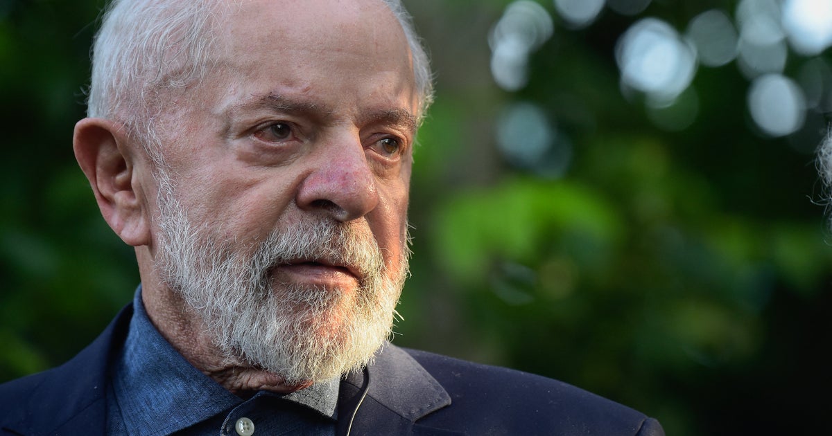 NextImg:Brazilian President Lula Undergoes Brain Surgery, Recovering In ICU