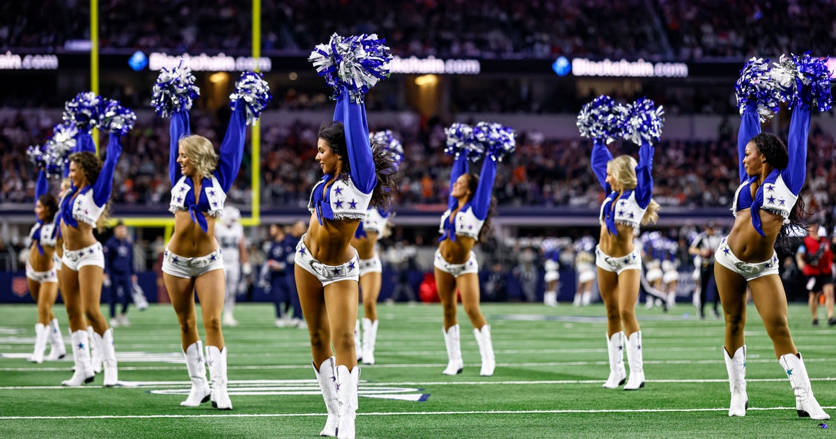 脱毛症のチアリーダーがウィッグをつけずにパフォーマンス「髪がなくて