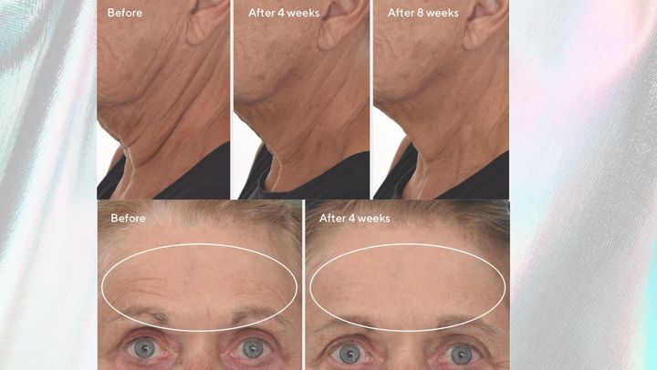 The Murad Retinal ReSculpt can target neck and jowl sagging as well as deeper-set wrinkles.