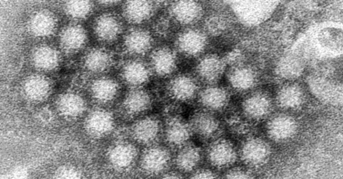 NextImg:Several Outbreaks Of This Contagious Virus Were Reported On Cruises In 2024