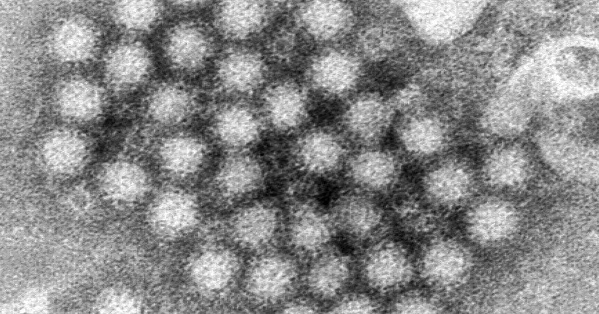 Nasty Norovirus Is Back In Full Force With U.S. Cases Spiking