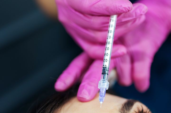 There are a few things to know before you start getting fillers or Botox.