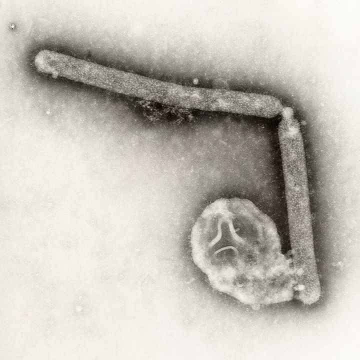 鳥インフルエンザA（H5N1）ウイルス粒子2個をとらえた電子顕微鏡画像。アメリカ疾病予防管理センター（CDC）提供