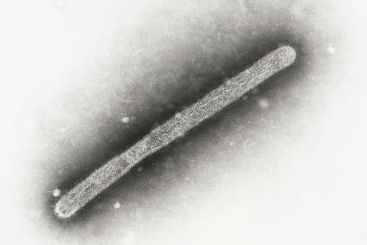 電子顕微鏡でとらえた鳥インフルエンザA（H5N1）ウイルス粒子。2005年に撮影