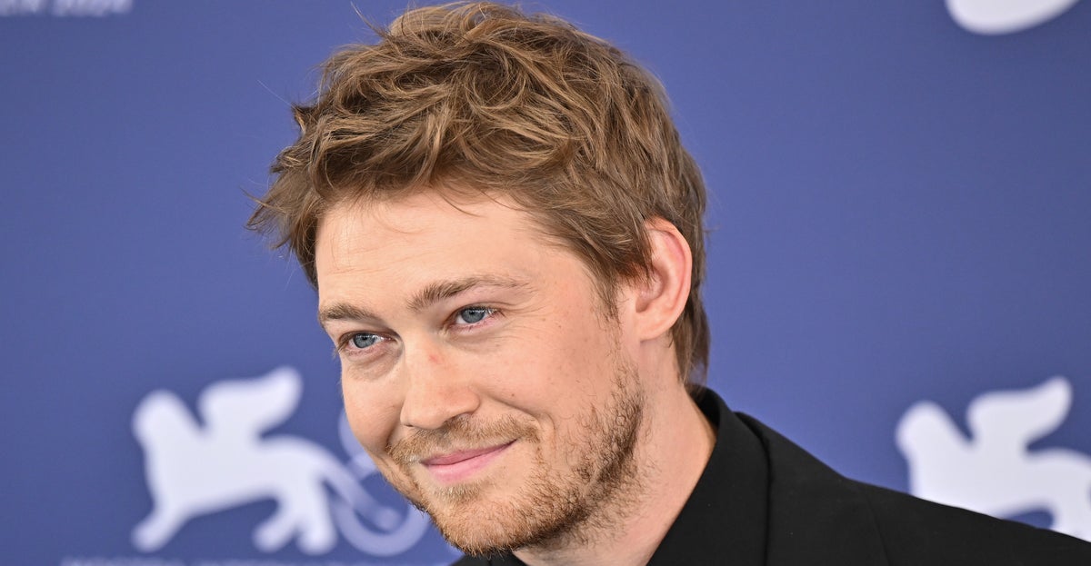 Taylor Swift's Ex Shares Bloody Childhood Prank That Left His Neighbors 'In Tears'