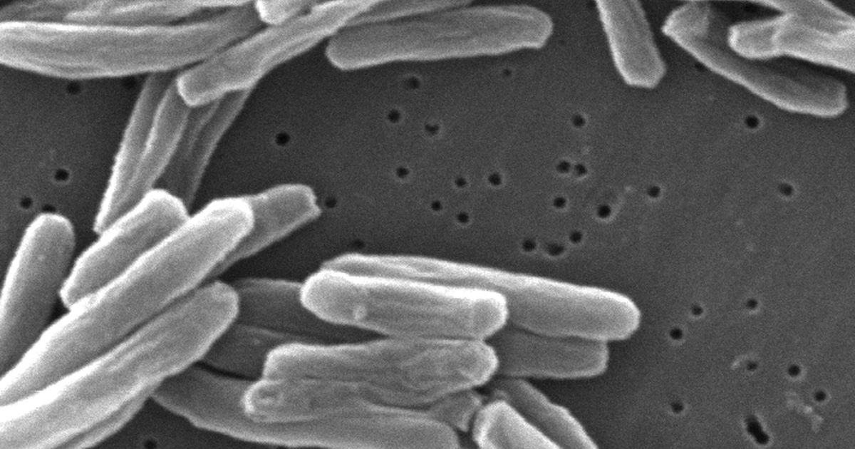 Kansas Health Officials Are Battling An ‘Unprecedented’ Tuberculosis Outbreak