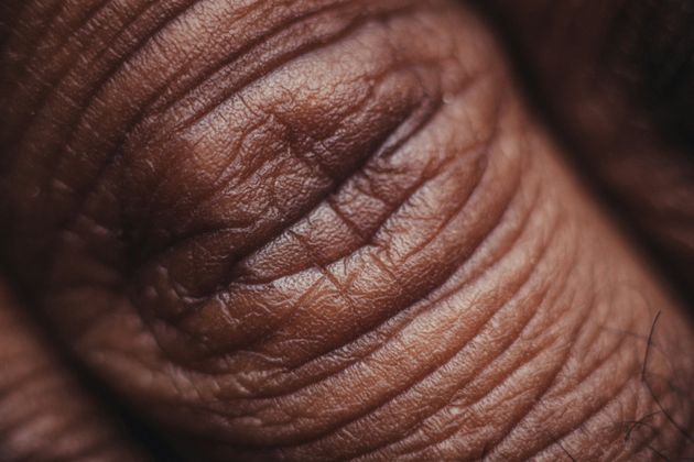 Closeup of skin on hand