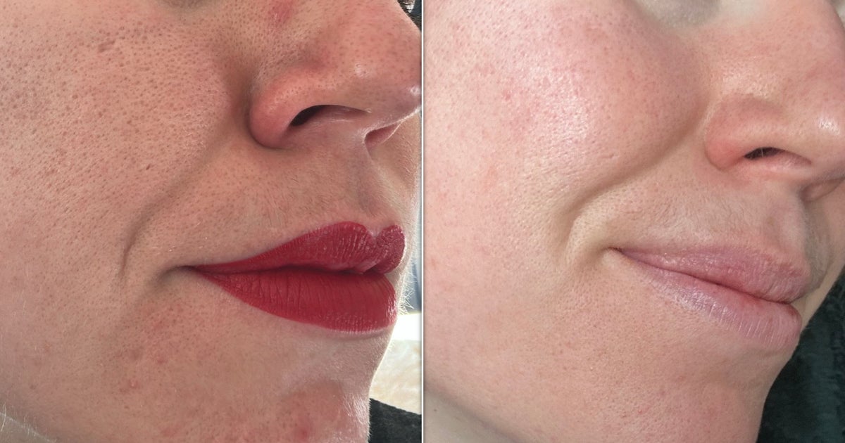 I Tried The Skin Care Dua Lipa 'Can't Live Without' – My Skin Cleared Up In 7 Days