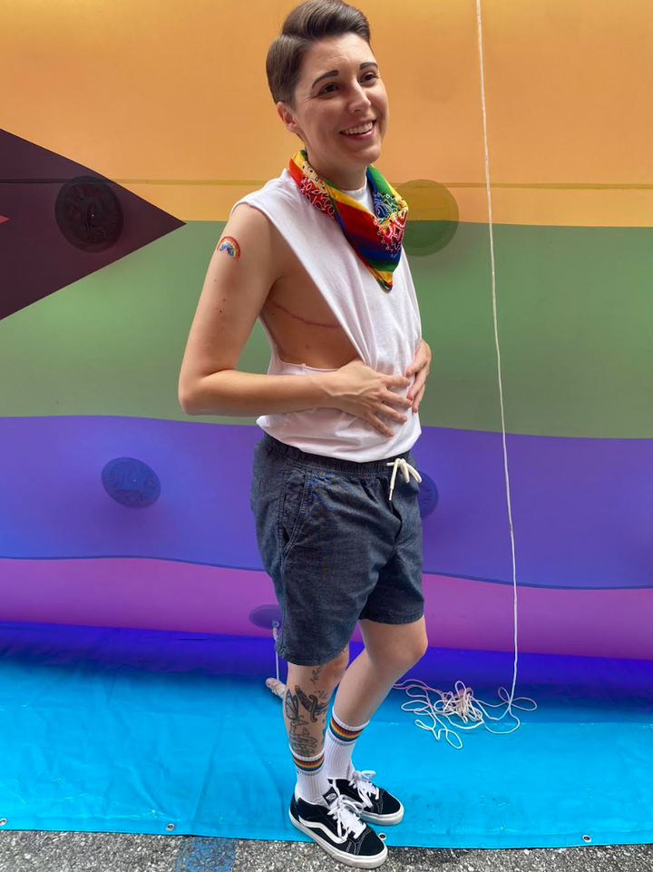 The author smiling and posing with visible top surgery scars at Philly Pride in June 2024.