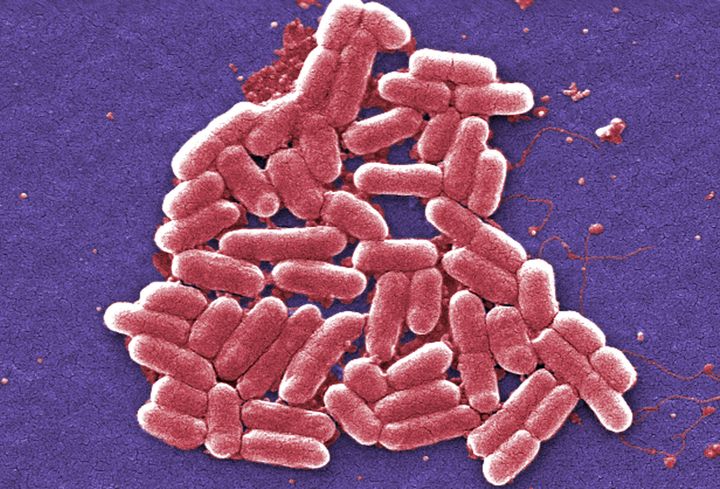 Το υπερμικρόβιο Escherichia Coli. 