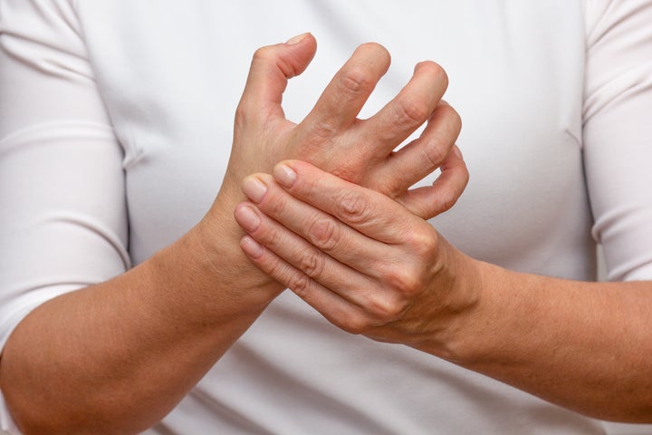 Woman hands showing hand with arthritis over cropped body