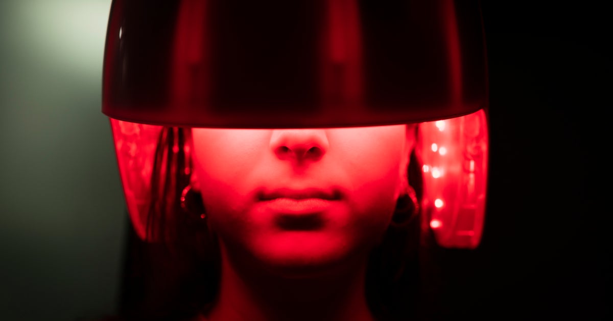 NextImg:Could Wearing A Simple Cap Be The Solution To Thinning Hair? Experts Have Thoughts.