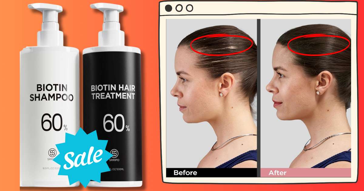 NextImg:Reviewers Say This Biotin Growth Shampoo Set Is A ‘Game Changer’ For Thinning Hair — And It’s Over 30% Off Right Now