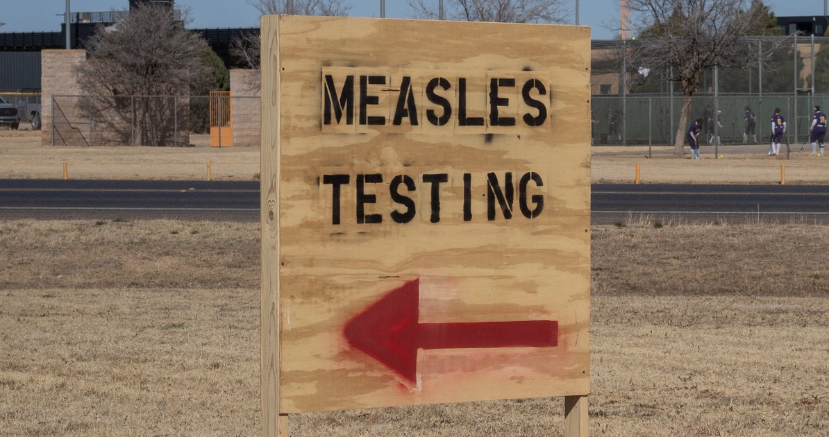 NextImg:Measles Cases Surpass 300 In Texas, New Mexico: Here's What You Should Know