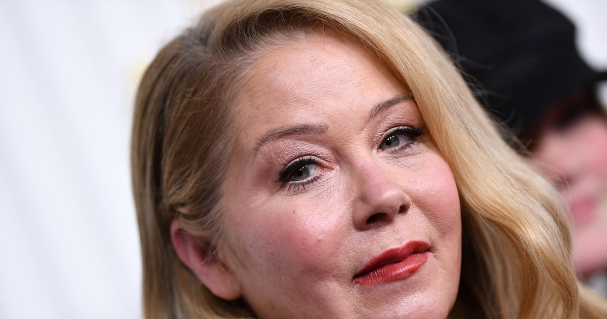 NextImg:Christina Applegate Says She's Been Hospitalized Almost 30 Times Since MS Diagnosis