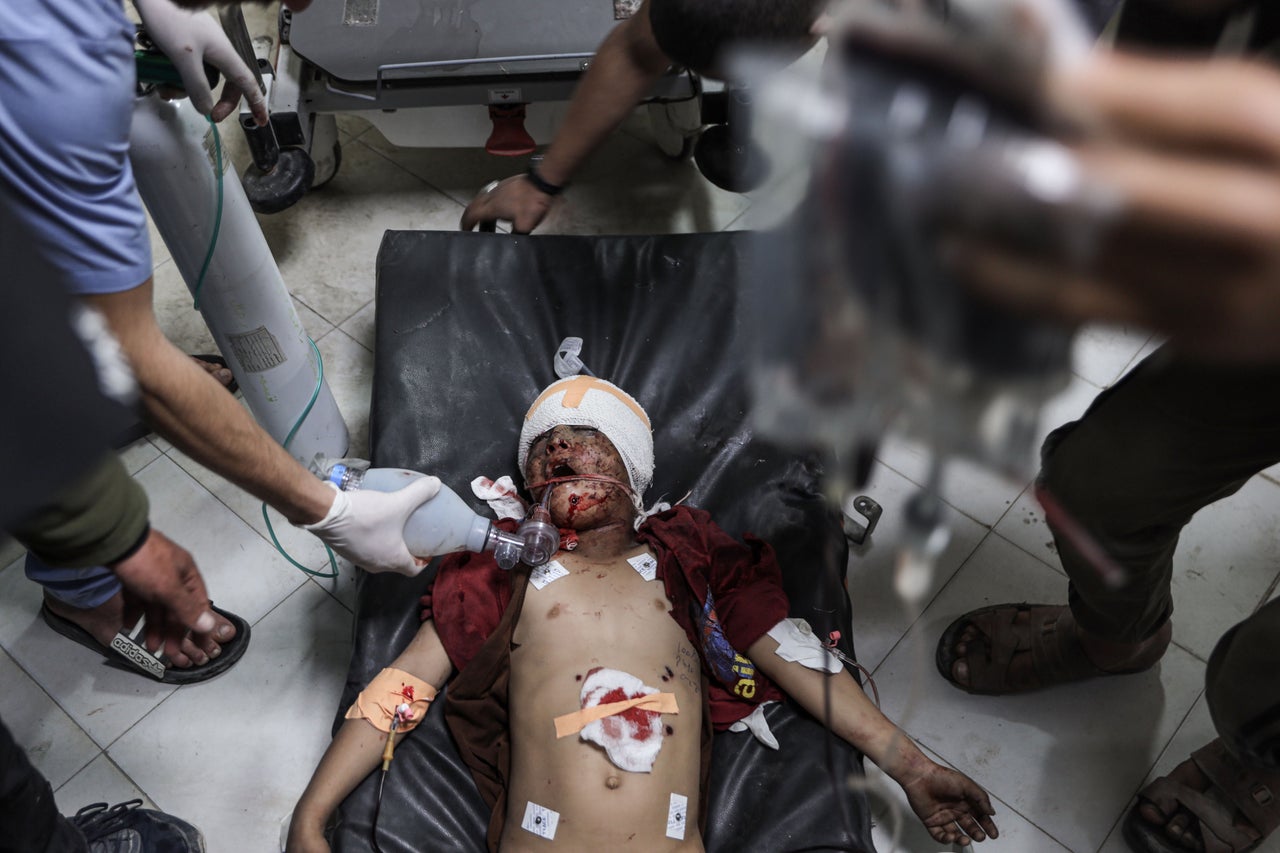 A Palestinian child wounded by an Israeli strike in central Gaza receives treatment at Indonesia Hospital in Beit Lahia on March 18, 2025.