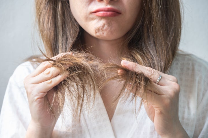 The only real treatment for split ends is to get them cut.