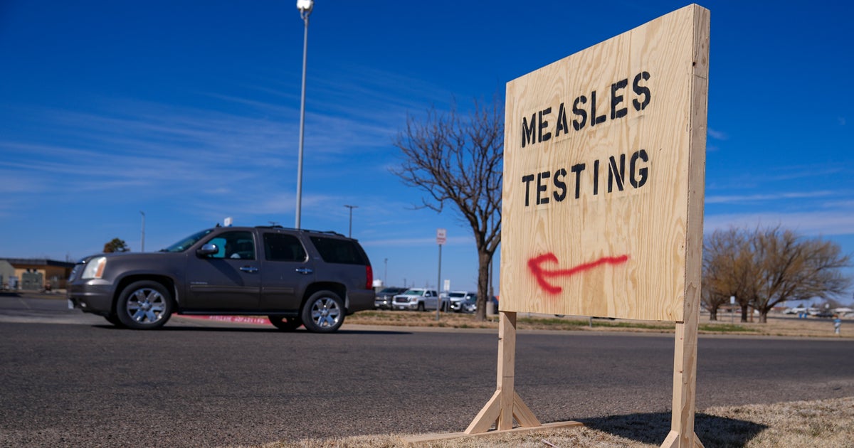 Texas Measles Outbreak Hits 400 Cases
