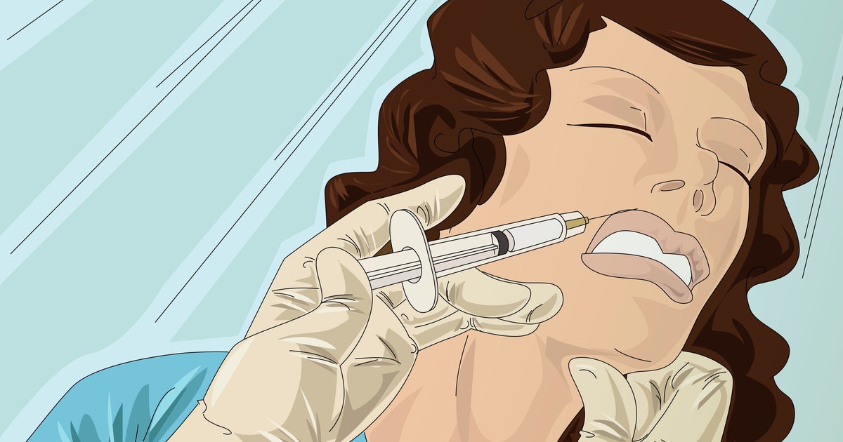 NextImg:11 Things Injectors Say You Should Never Do After Getting Botox — And Why