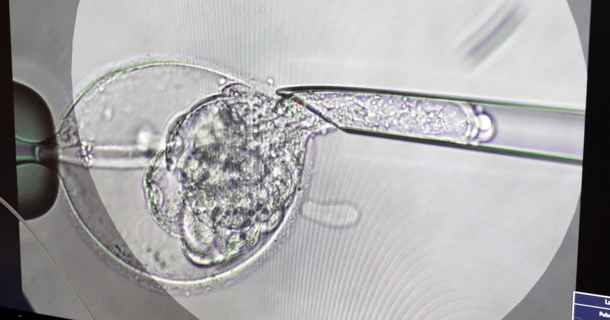 Australian Woman Unknowingly Gives Birth To Stranger's Baby After IVF Error