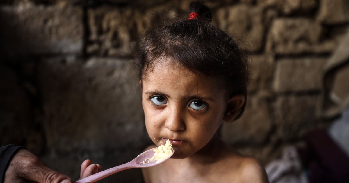 NextImg:'Let The Children Eat': Israel Is Starving Gaza To Death, Doctors And Experts Warn