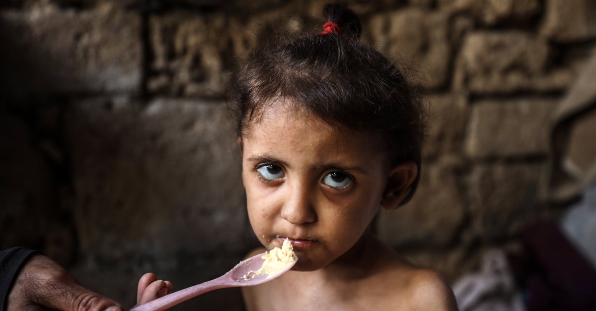 'Let The Children Eat': Israel Is Starving Gaza To Death, Doctors And Experts Warn