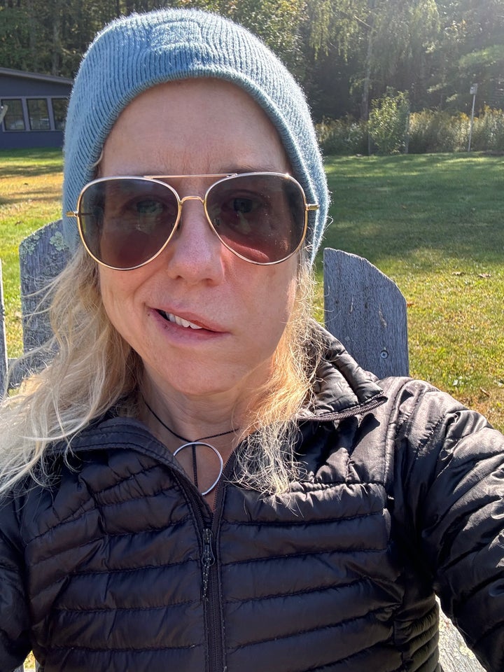 Lauren Weedman shared photos after experiencing symptoms of Bell's palsy.